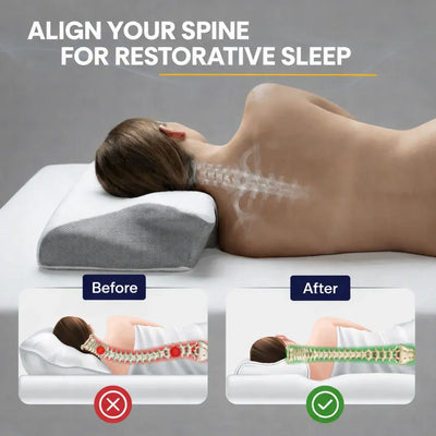 Solera CerviSoft Pillow™